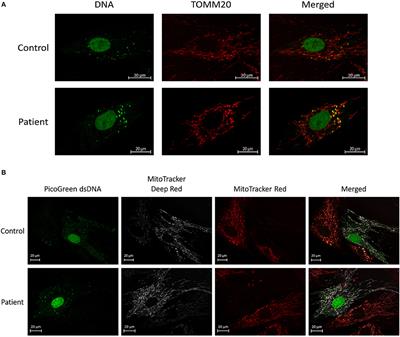Mesenchymal Stem Cells Shift Mitochondrial Dynamics and Enhance Oxidative Phosphorylation in Recipient Cells